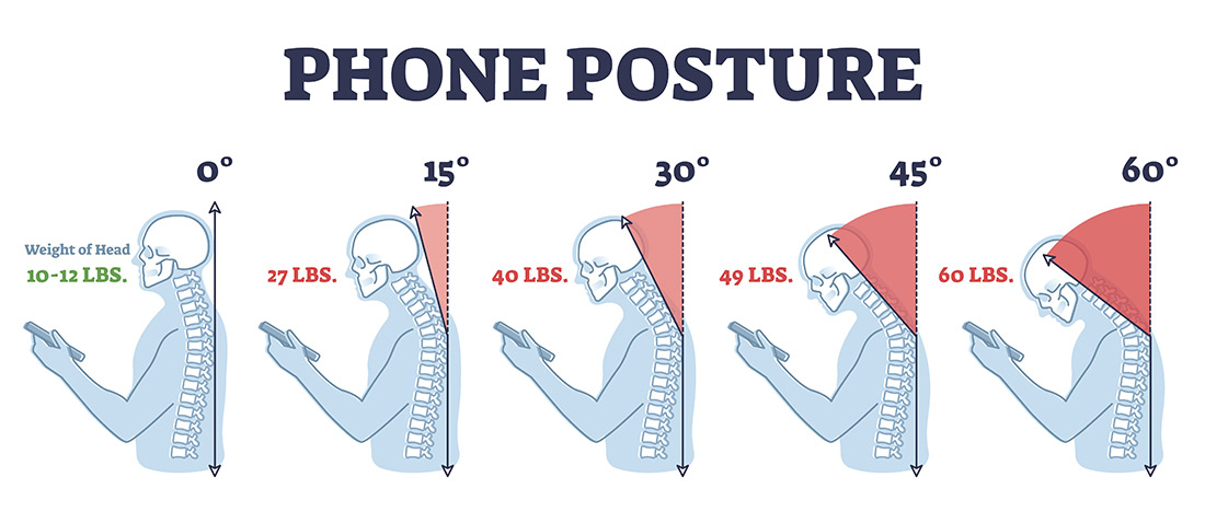 How to Fix Text Neck that is Killing your Good Posture